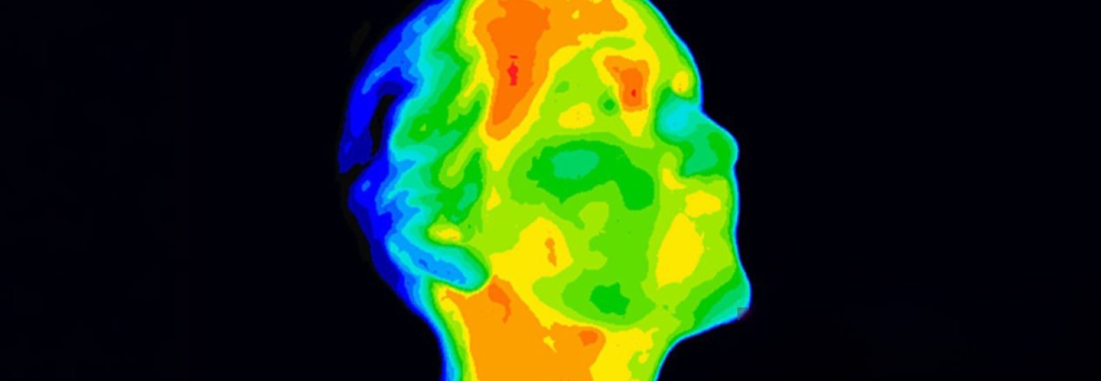 Neurologic Thermography Scans